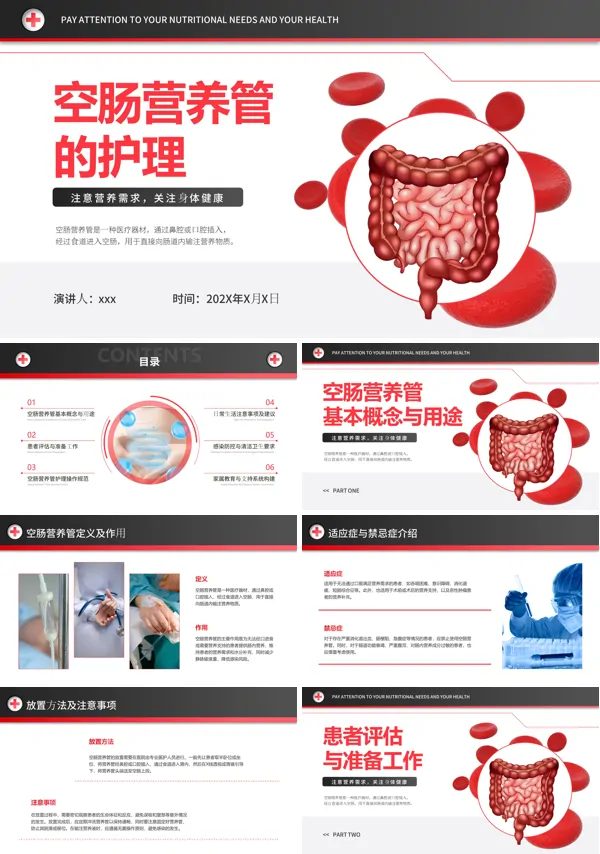 空肠营养管的护理ppt含讲稿