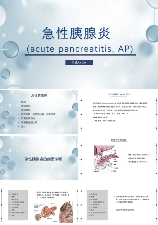 急性胰腺炎护理查房PPT