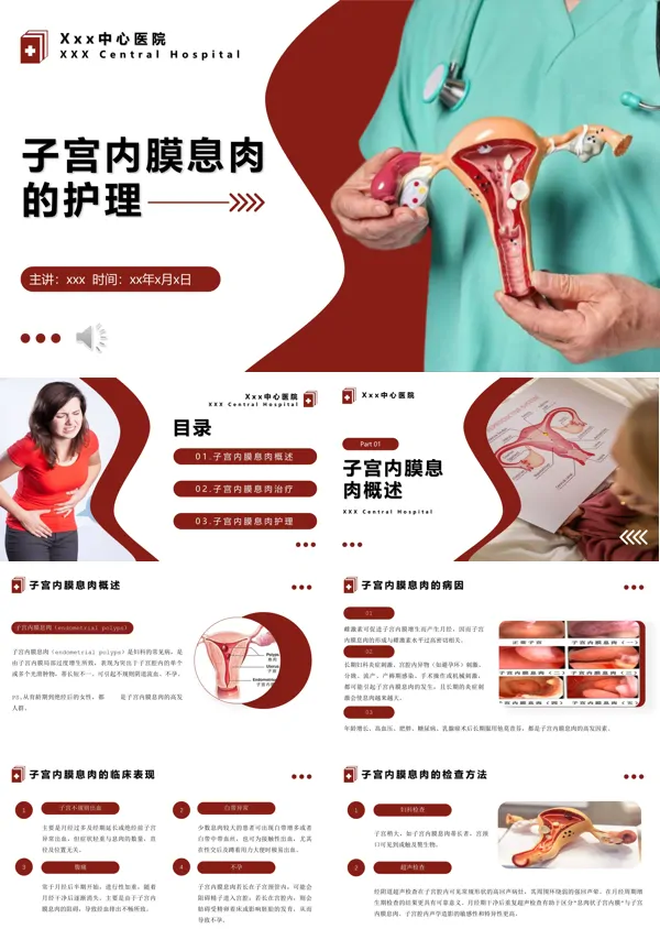 子宫内膜息肉的护理PPT模板