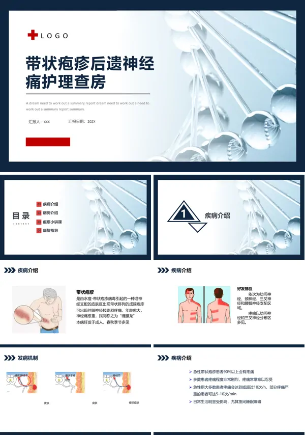 带状疱疹后遗神经痛护理查房PPT课件