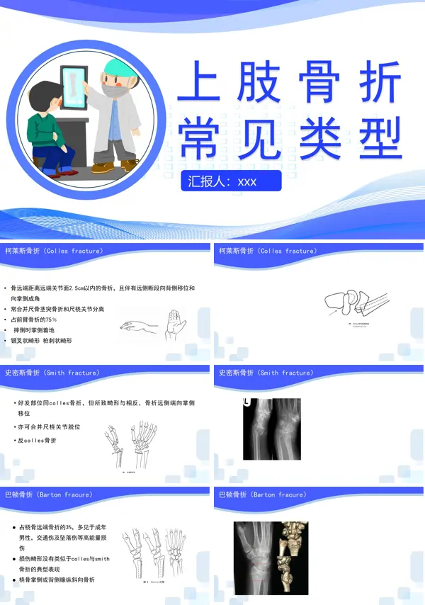 上肢骨折常见类型PPT下载课件模板