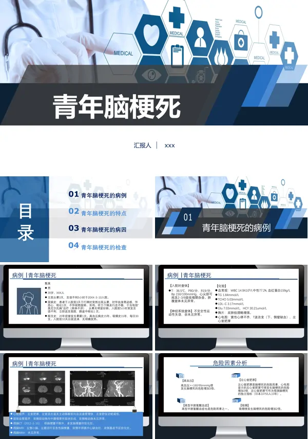 青年脑梗死PPT下载模板