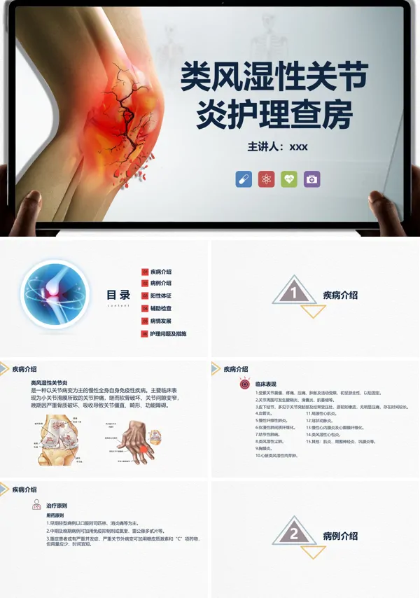 类风湿性关节炎护理查房PPT模板含讲稿