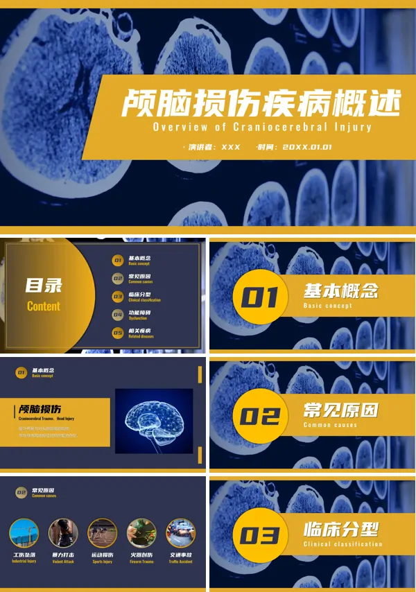 颅脑损伤的概述PPT课件