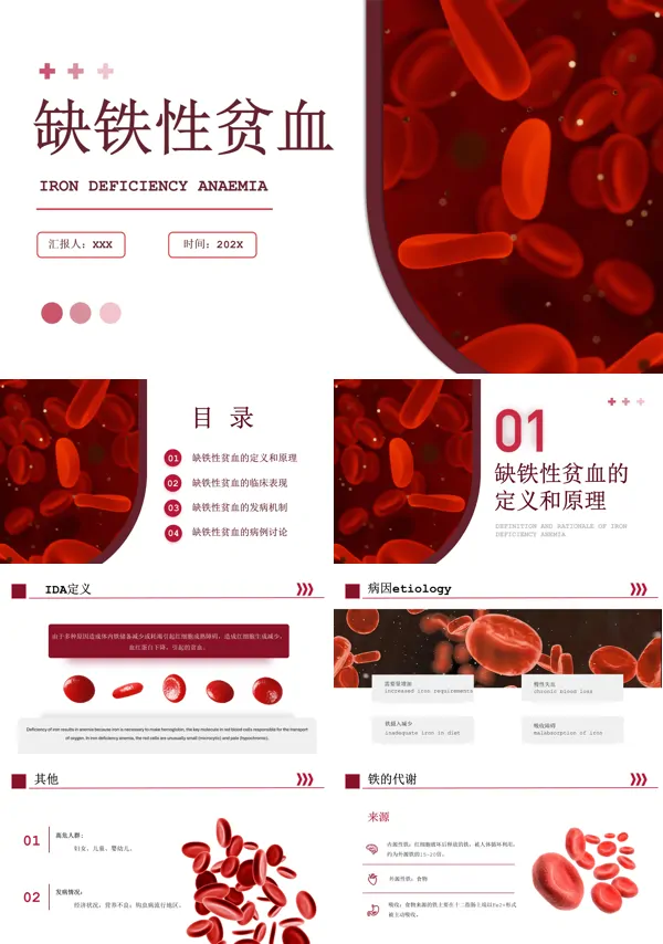 缺铁性贫血课件PPT课件