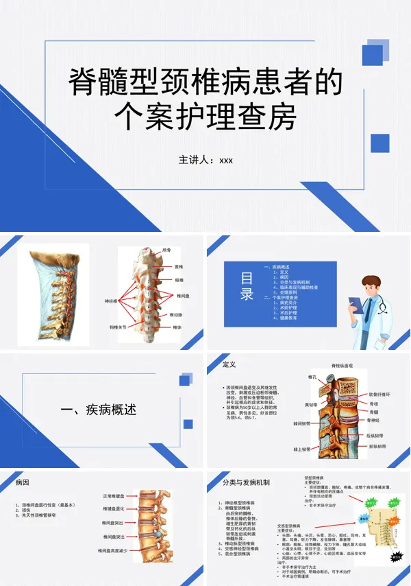 脊髓型颈椎病患者的个案护理查房PPT模板含讲稿