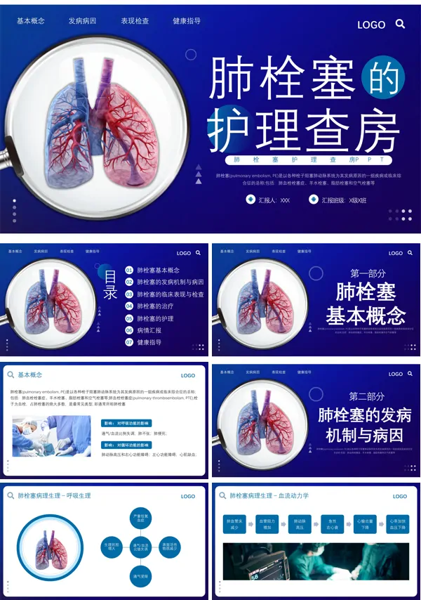 肺栓塞病人护理查房PPT课件