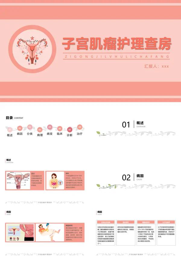 子宫肌瘤病人的护理查房ppt模板含讲稿