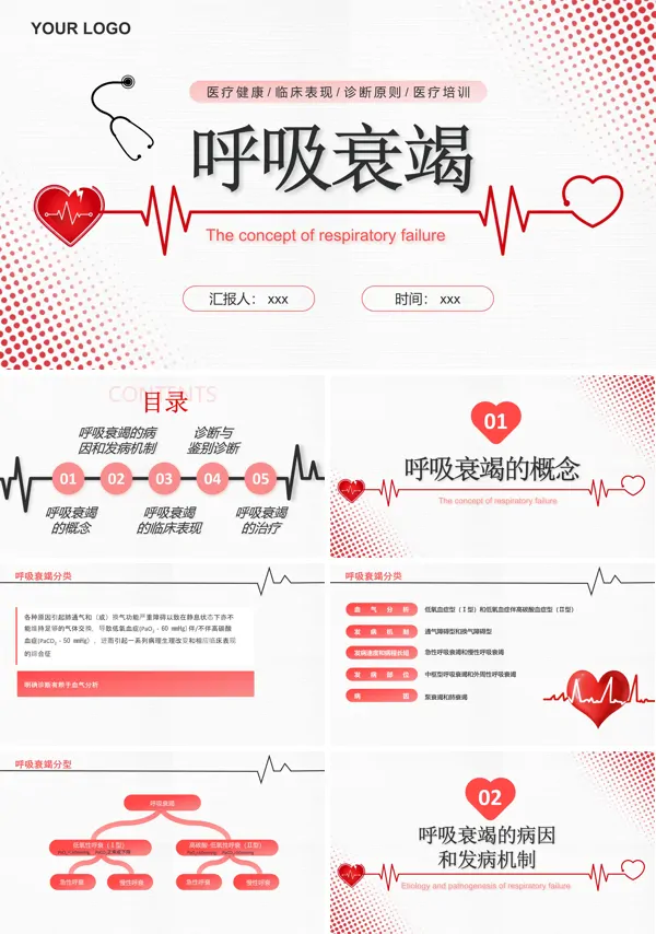 呼吸衰竭ppt课件