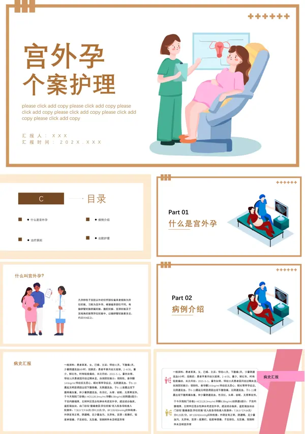 宫外孕个案护理查房PPT课件