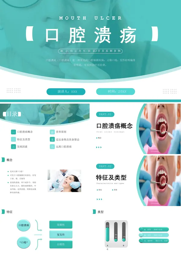 口腔溃疡知识PPT课件免费下载