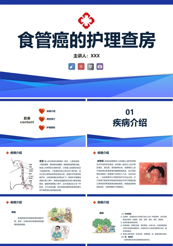 食管癌的护理查房护理措施PPT
